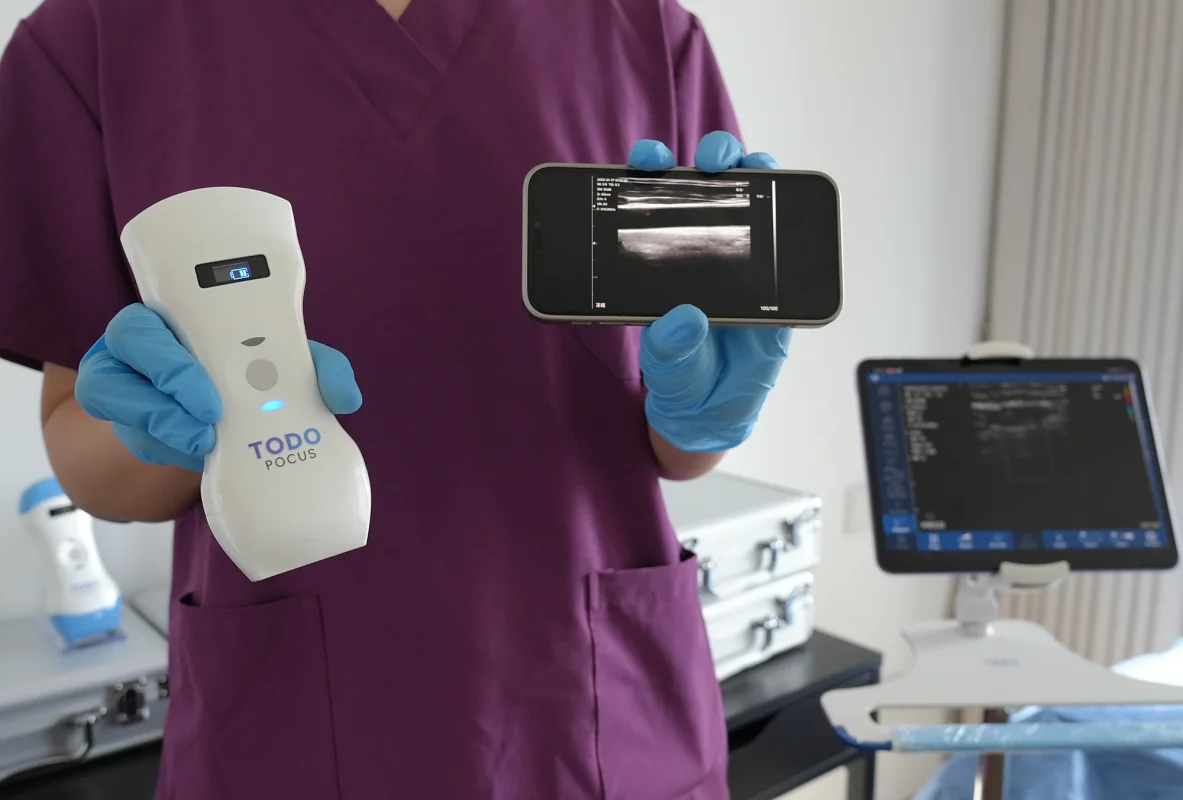 beste draadloze echoscanner todo pocus d3pro voor nier schildklier vasculair cardiaal