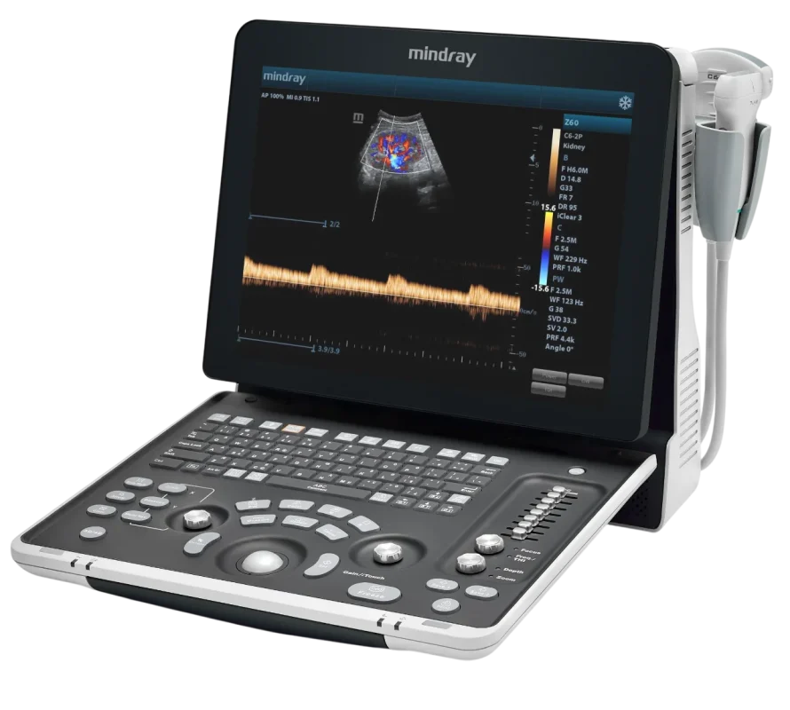 mindray z60