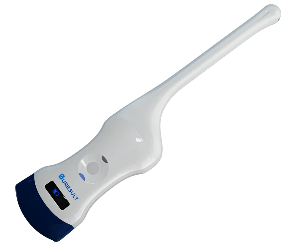 suresult d2t convexe transvaginale dual-probe echografie gespecialiseerd voor gynaecologie en verloskunde