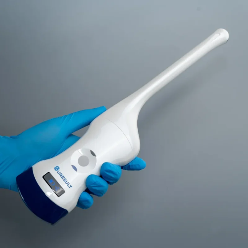 d2t convexe en transvaginale draadloze echografie, 192 elementen, kleurendoppler
