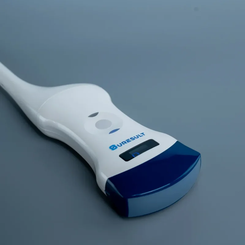 d2t convexe en transvaginale draadloze echografie, 192 elementen, kleurendoppler
