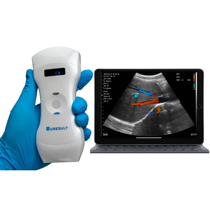d3pro draadloze 3-in-1 kleurendoppler-echoscanners met 192 elementen, lineair, convex en phased array