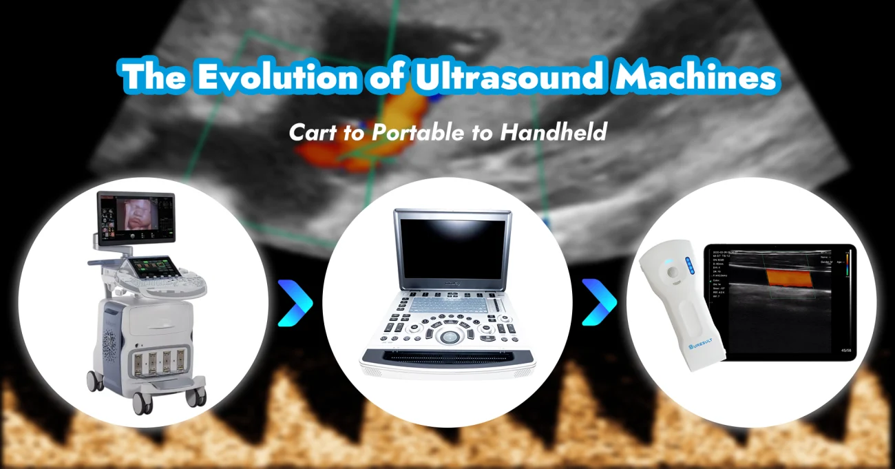 de evolutie van echoapparaten van cart naar draagbare tot handheld echografie