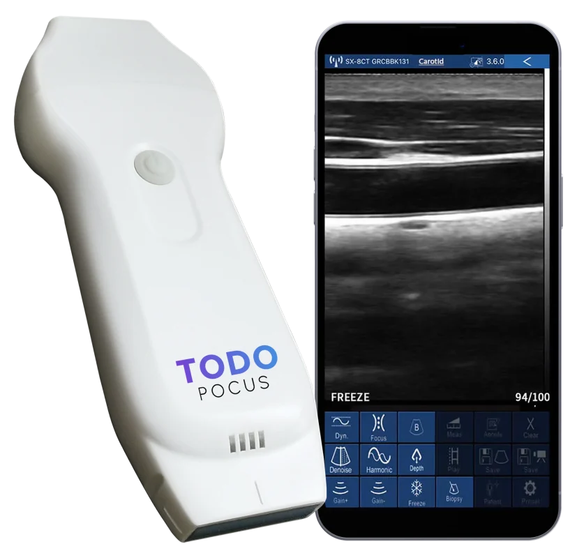 todopocus cd2