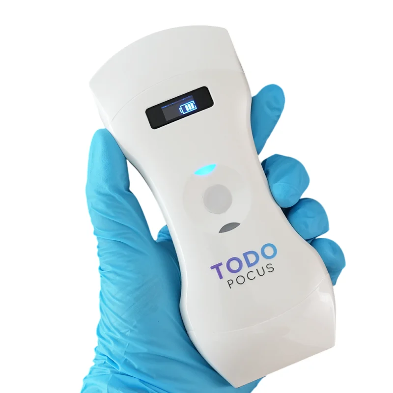 todopocus d3pro lichte draadloze draagbare pocket-echoscanner beste prijs