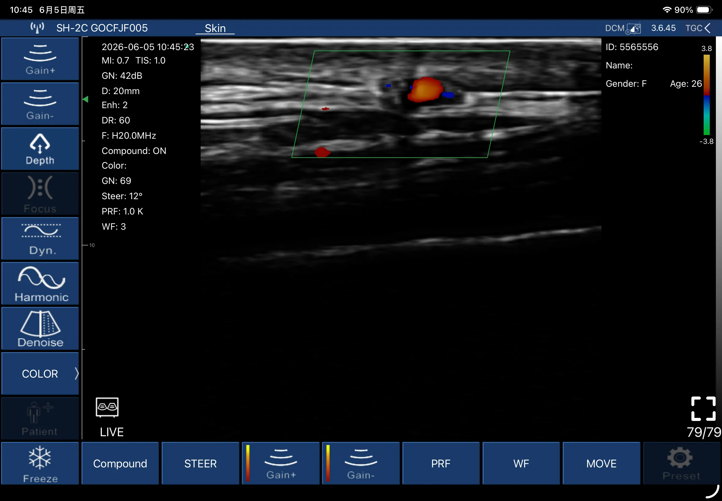 L20Pro 20 MHz Superficial Vessel Color Doppler Scan scan preview