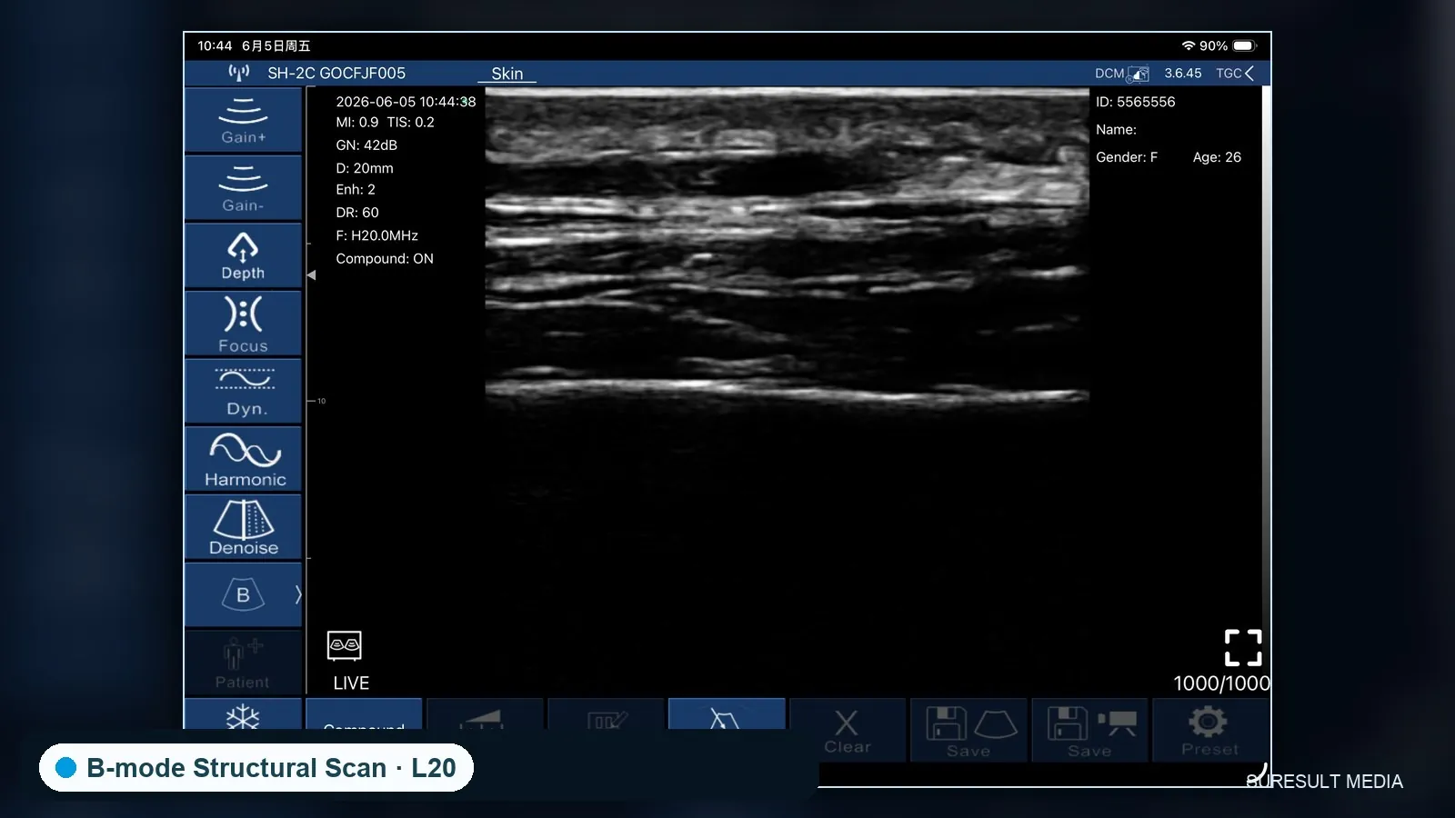 Facial superficial tissue · B-mode · L20 · Linear probe scan preview