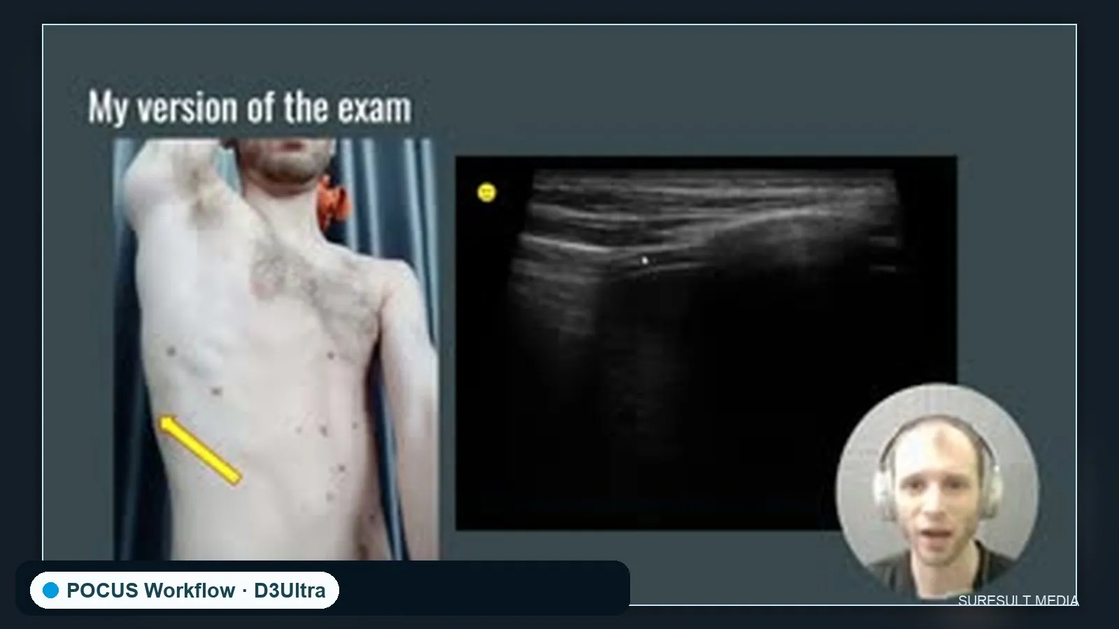 eFAST trauma exam · POCUS · D3Ultra scan preview
