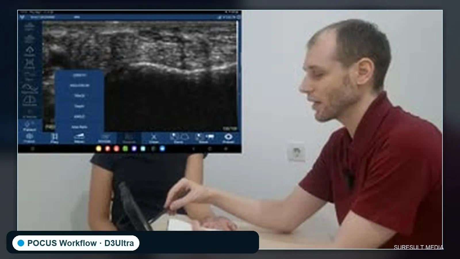 Median nerve at the carpal tunnel · B-mode · D3Ultra · Linear probe scan preview