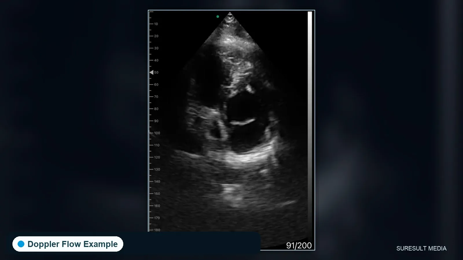 Cardiac view · Color Doppler · CD2 · 3.6 MHz scan preview