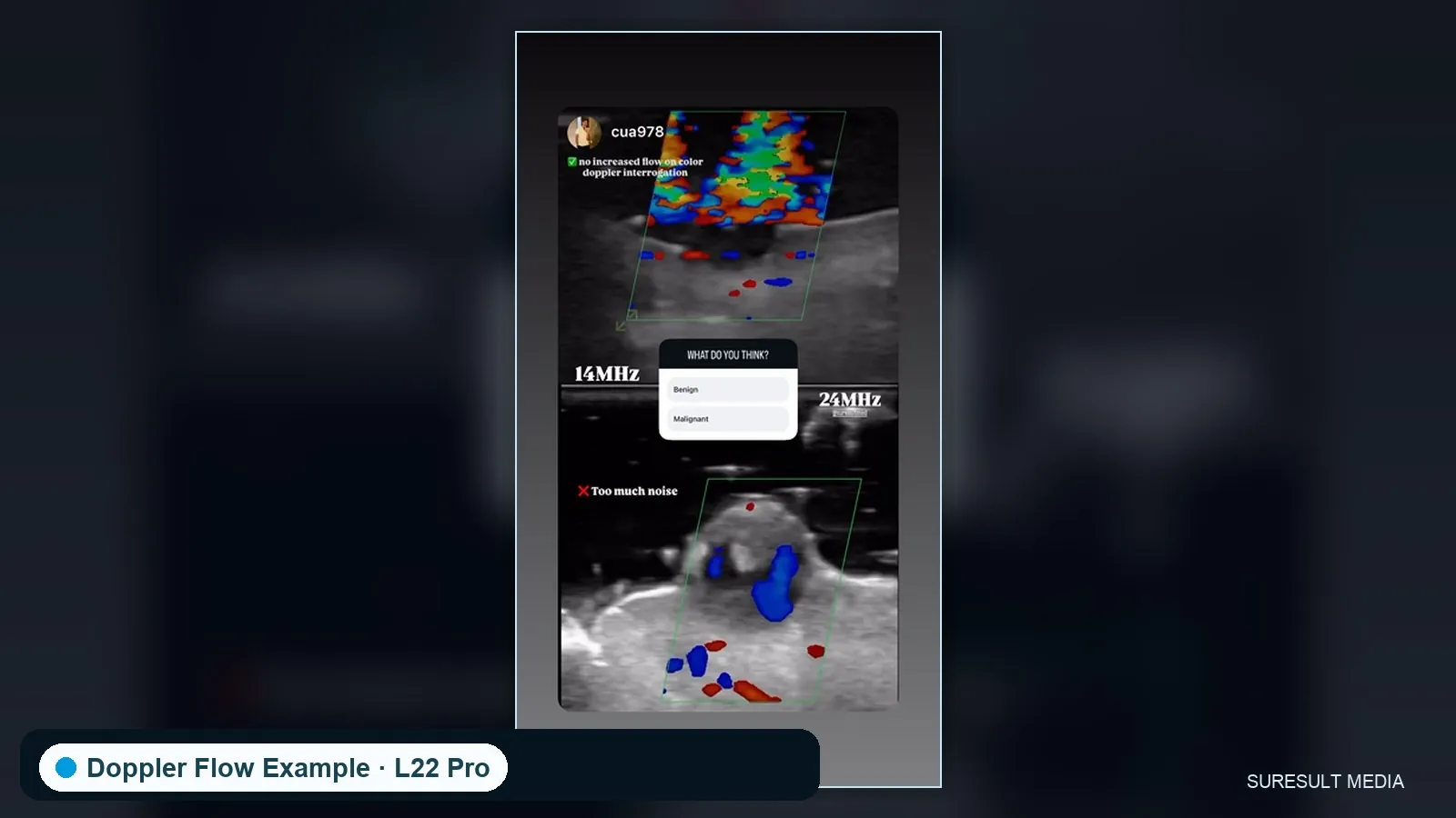 Facial superficial vessels · Color Doppler · L24Pro · Linear probe scan preview