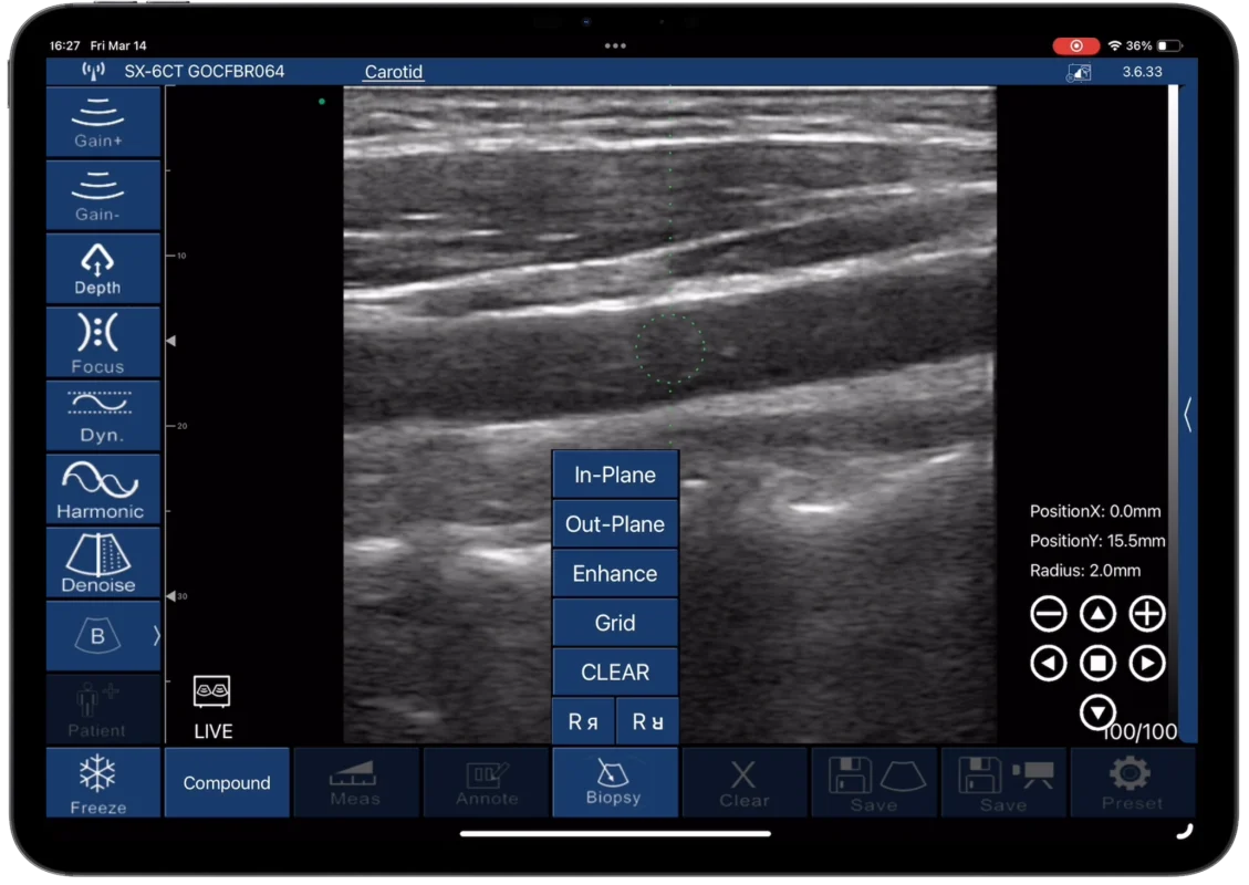 In-plane and out-of-plane needle guides with position readouts on screen