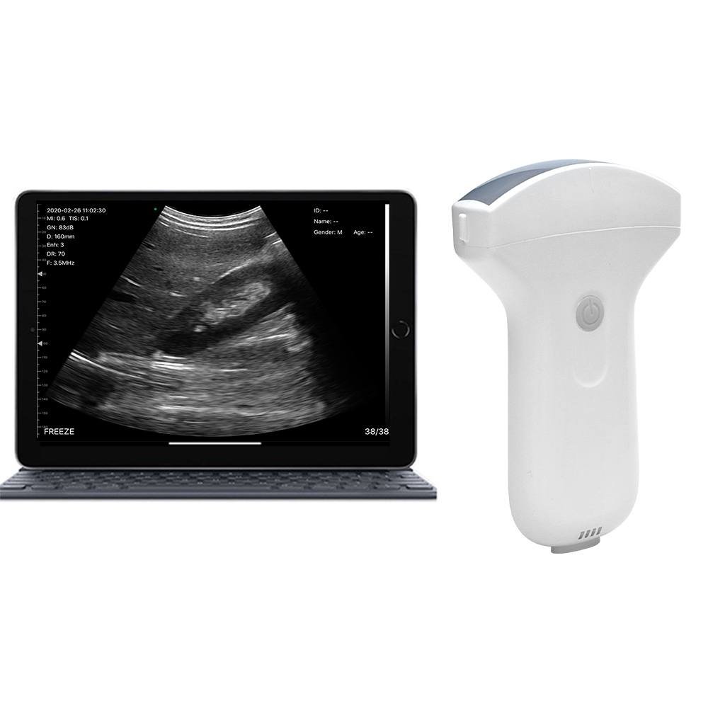 TodoPocus C5S convex handheld ultrasound with tablet