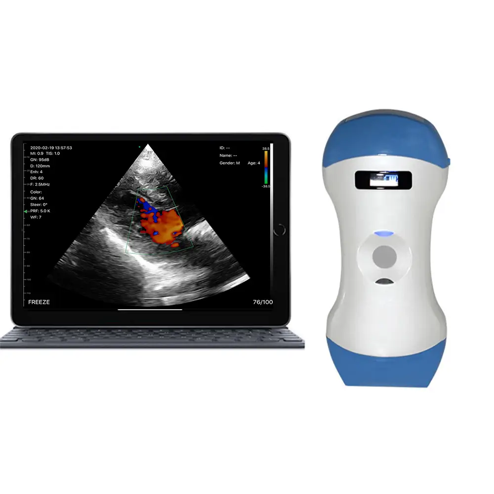 Veterinär-Ultraschallscanner tragbar Farbdoppler