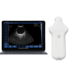 Suresult E11 draadloze microconvexe echoprobe met tablet