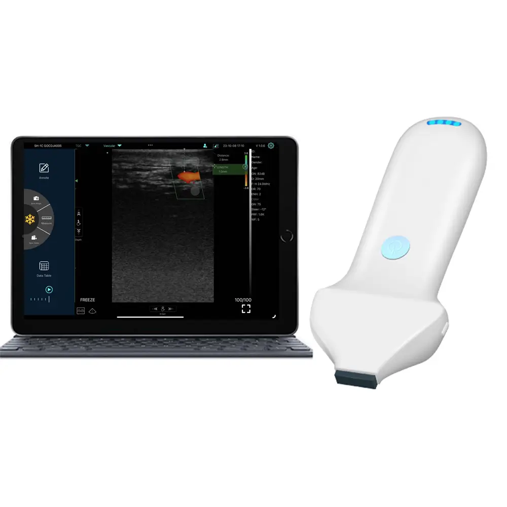 Suresult L24 18/24 MHz aesthetic ultrasound probe product image