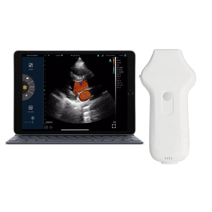 Suresult PD1 portable handheld ultrasound phased probe for cardiac POCUS