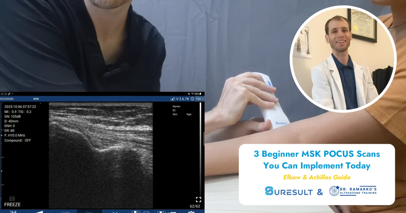 3 beginner msk pocus scans elbow achilles guide