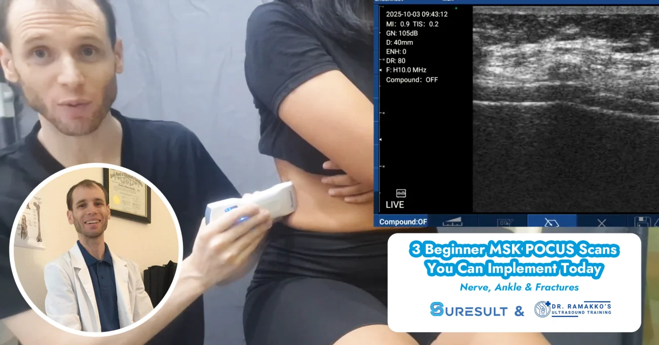 3 beginner msk pocus scans nerve ankle fractures