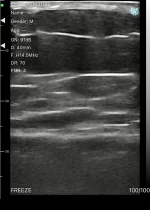 aesthetics 02 superficial soft tissue planes l14