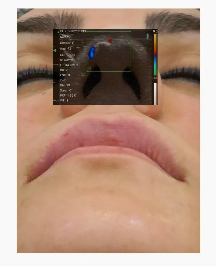 Doppler overlay on the treatment photo