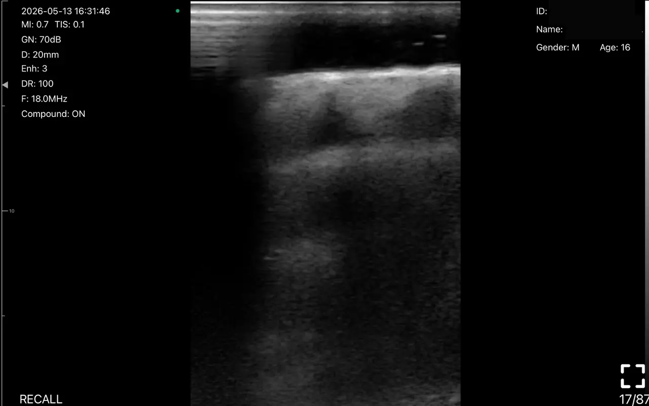 Aesthetics: aesthetics 15 scalp soft tissue dynamic pass 18