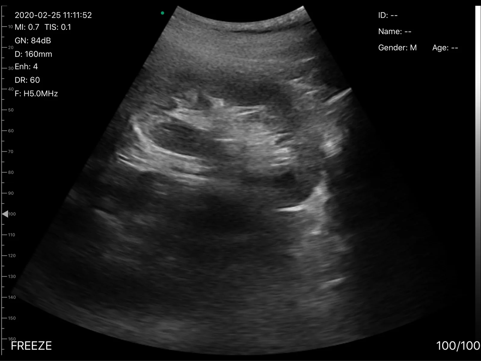 Primary Care ultrasound