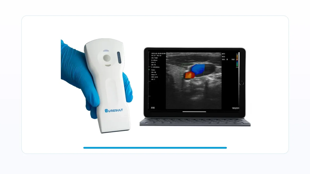 Suresult D3Ultra Handultraschallgerät mit Farb-Doppler-Funktion für unter 5.000 Dollar – Kaufvergleich