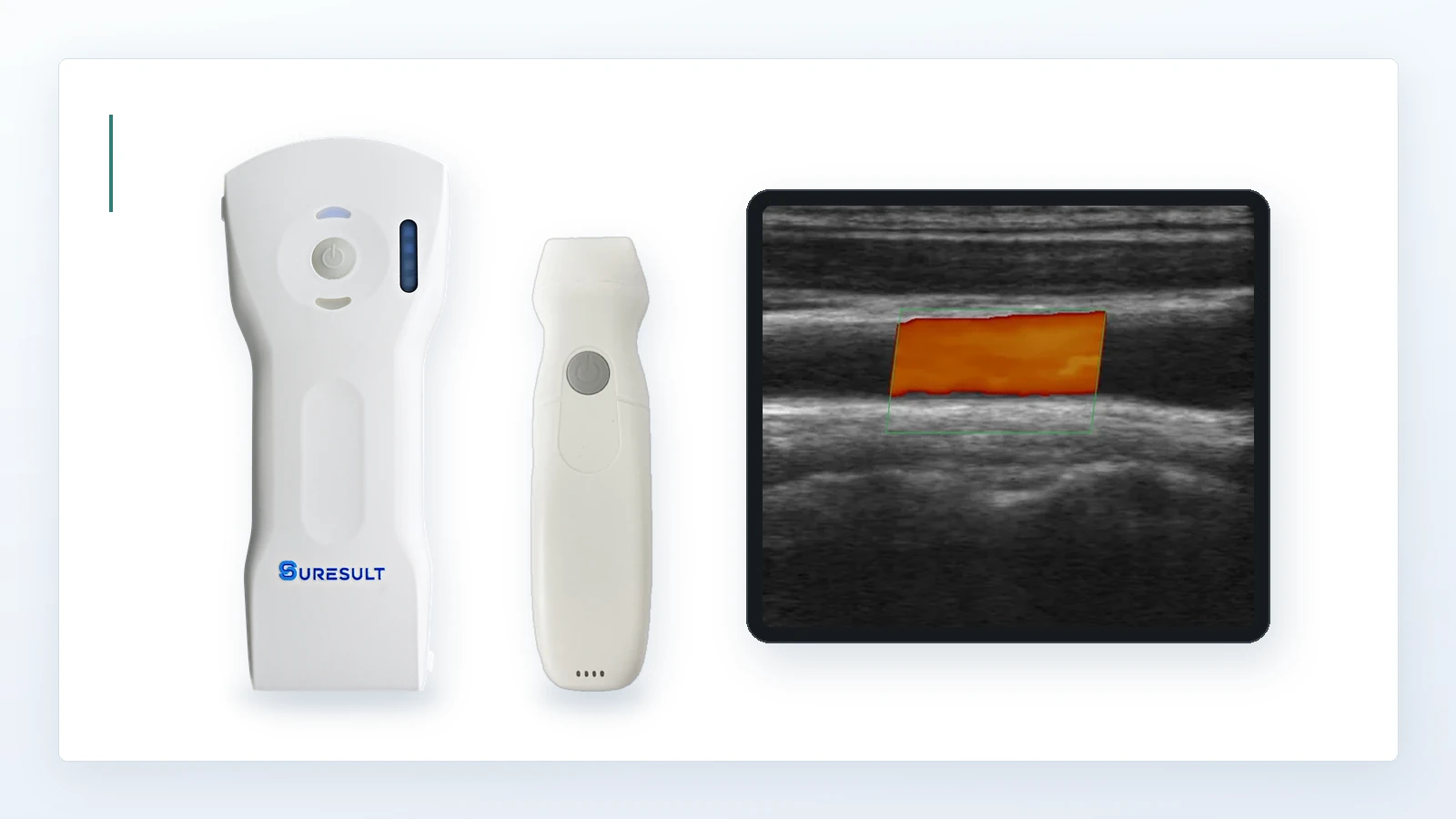 Suresult D3Ultra and PD2 wireless ultrasound probes beside a D3Ultra carotid Color Doppler image