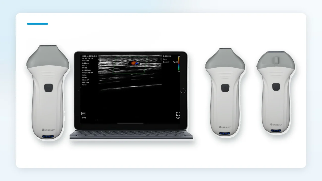 Suresult L20Pro, L24Pro and L14Pro handheld linear ultrasound probes with a live linear scan on tablet