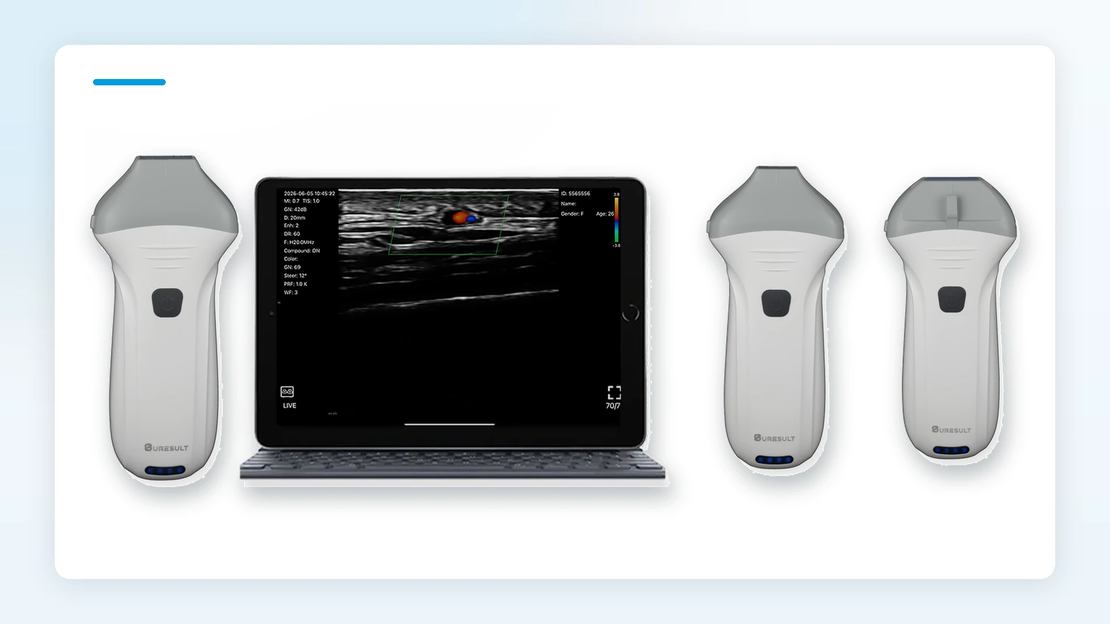 Suresult L20Pro-, L24Pro- en L14Pro-lineaire handheld-echoprobes met een live lineaire scan op een tablet