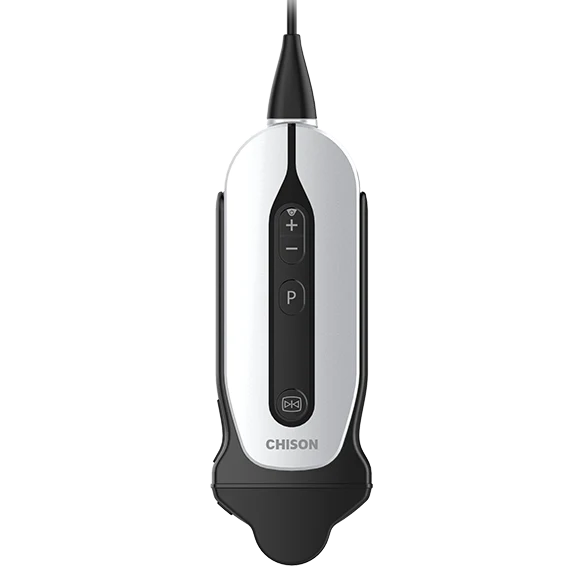 CHISON SonoEye handheld echoapparaat productafbeelding voor kopersvergelijking