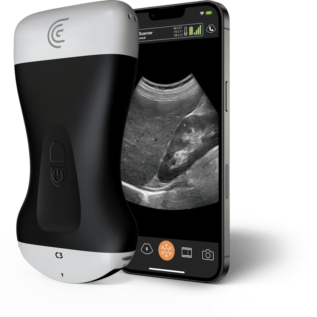 Clarius C3 HD3 wireless convex handheld ultrasound scanner beside a phone running the Clarius app