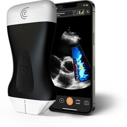 Clarius PAL HD3 handheld ultrasound