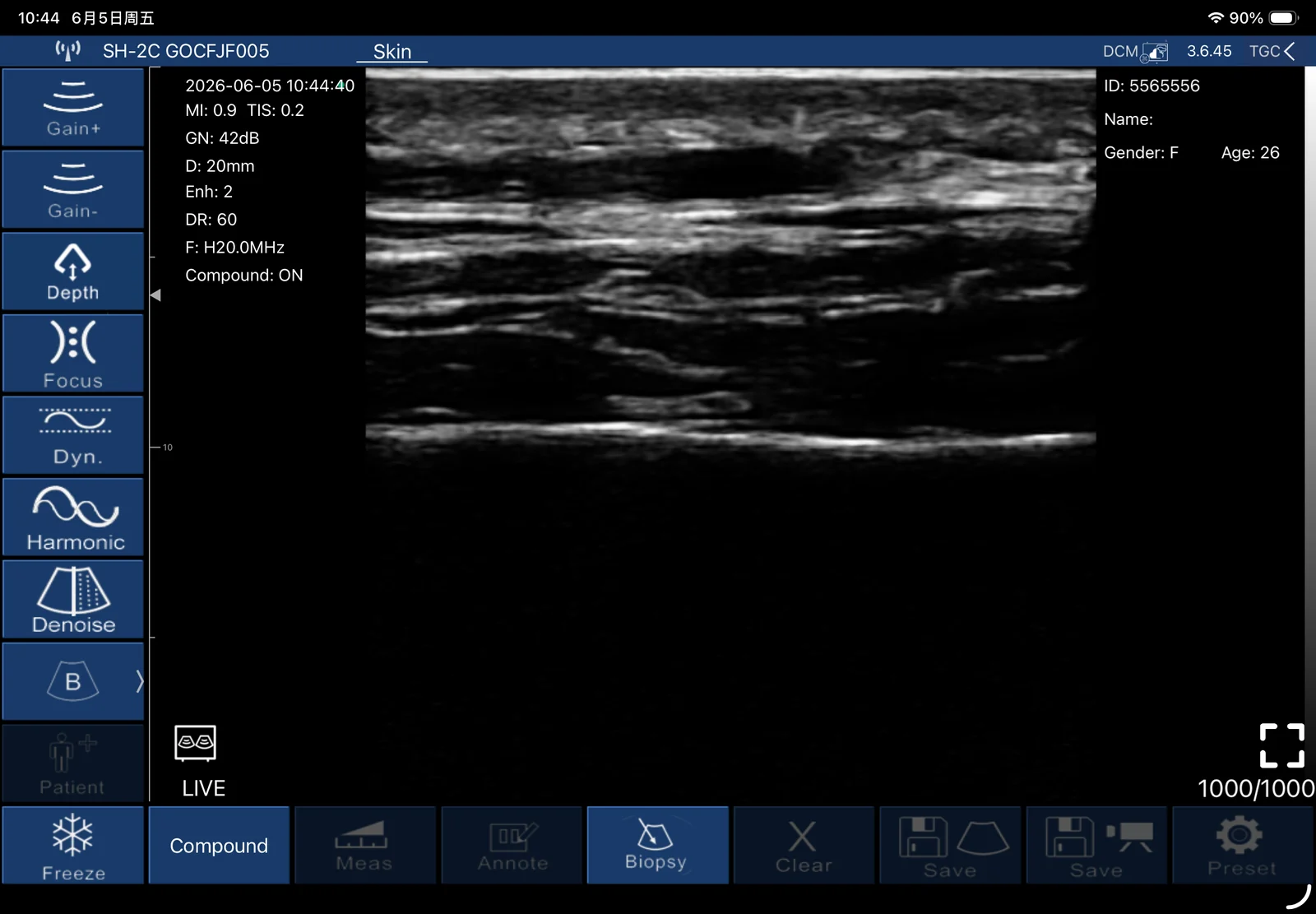 Dermatology: dermatology 01 skin subcutaneous layers longitudinal b mode