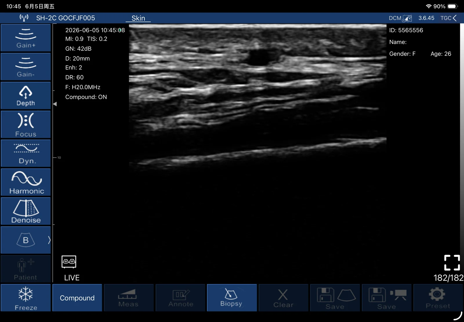 Set gain low and dynamic range wide for layer contrast.