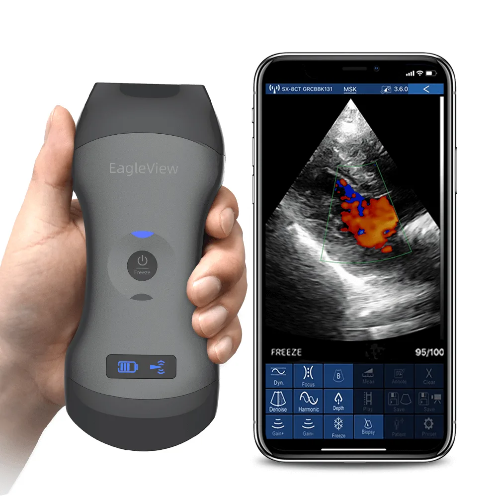 Official EagleView CProbe-CL wireless handheld ultrasound and mobile app display