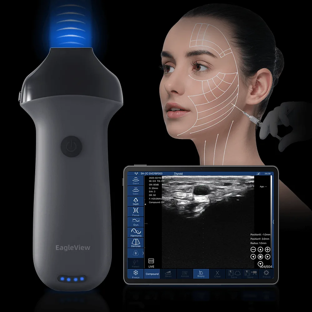 Official EagleView CProbe-L high-frequency linear wireless ultrasound for superficial imaging