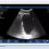Suprapubic pelvic window of an eFAST exam on the Suresult D3Ultra handheld ultrasound, bladder filling the near field at 160 mm depth