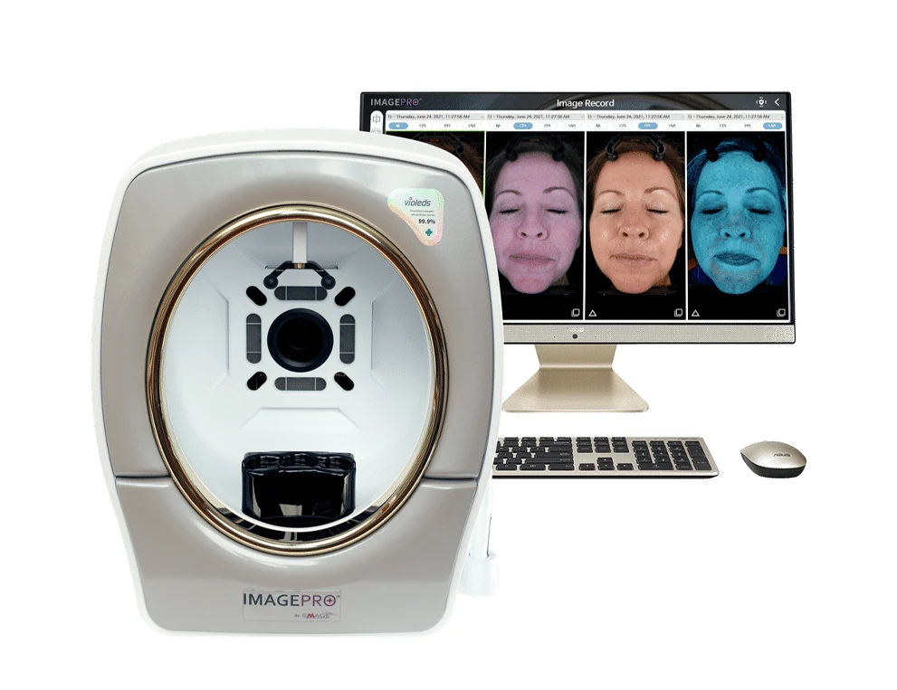 영상 기록 모니터 옆의 Emage ImagePro SUNLITE 피부 분석기