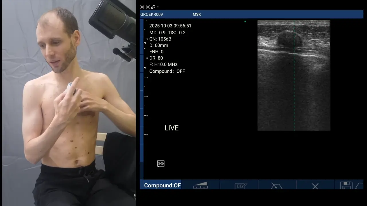 A full lung sweep on a Suresult handheld
