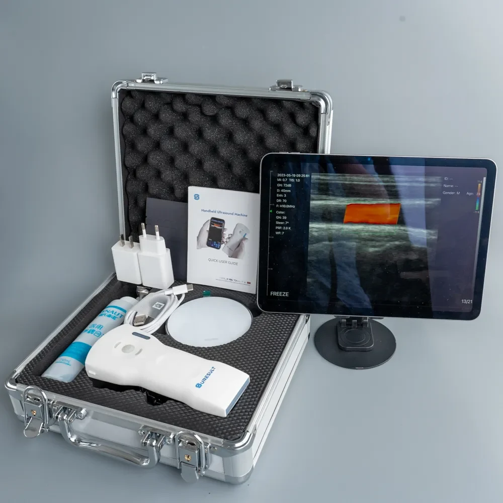 Suresult D3Ultra handheld ultrasound in its aluminum case with tablet, wireless charging pad, chargers and quick user guide