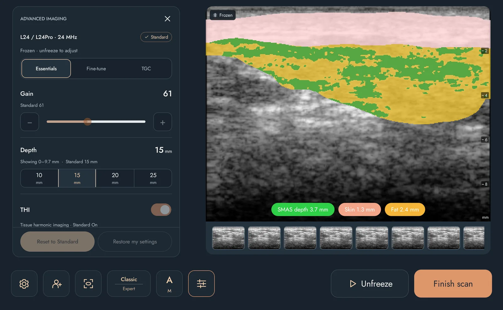 Geavanceerd beeldvormingspaneel voor de L24 / L24Pro-probe met gain-, diepte- en THI-regelaars naast een bevroren AI-laagbeeld