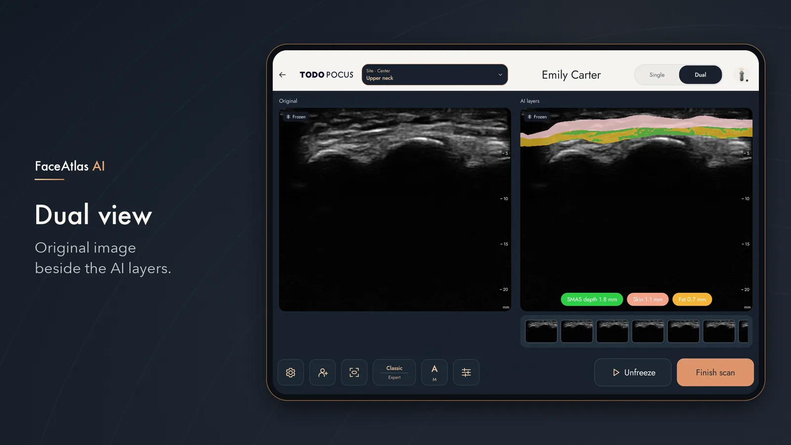 FaceAtlas AI Dual View toont origineel echobeeld naast AI-weefsellagen op een tablet