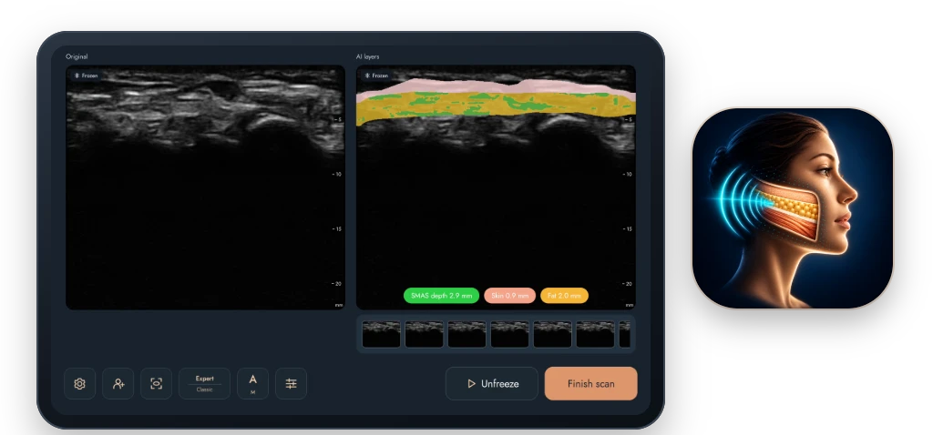 AI가 표시한 피부, 지방 및 SMAS 층을 보여주는 Android 태블릿의 FaceAtlas AI 앱