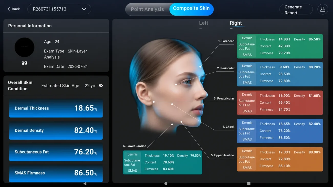 FacialAI composite skin view with six facial points and per-point dermis, subcutaneous fat and SMAS readouts