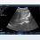 Interface de ultrassom portátil Suresult D3Ultra exibindo uma imagem do quadrante superior direito: fígado, rim direito e recesso hepatorrenal, com a predefinição “Abdômen”, profundidade de 160 mm e ganho de 97 dB no painel