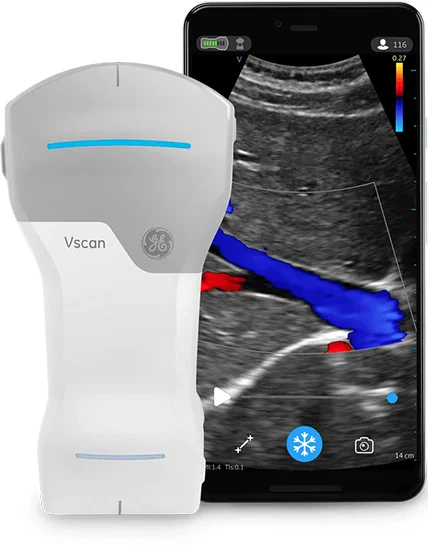 GE Vscan Air CL curved and linear handheld ultrasound product reference