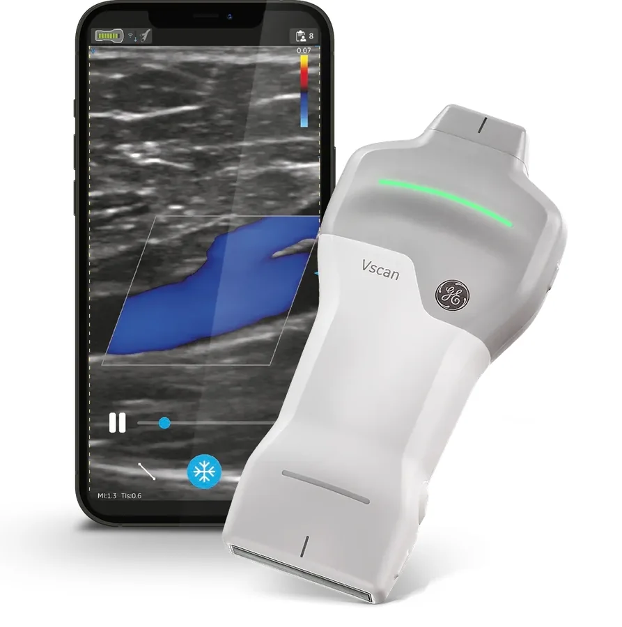 GE Vscan Air SL dual-array wireless probe