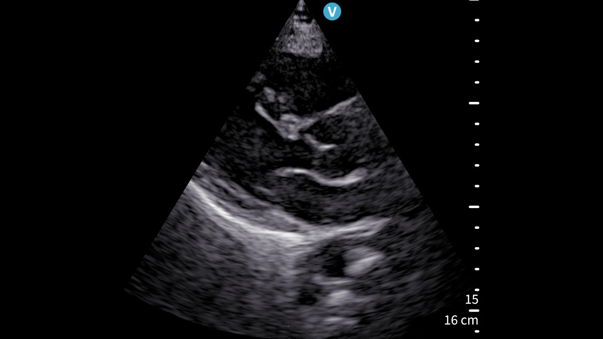 GE Vscan Air SL handheld cardiac ultrasound product image